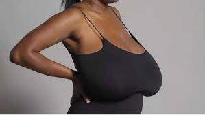 breast sagging after weight loss