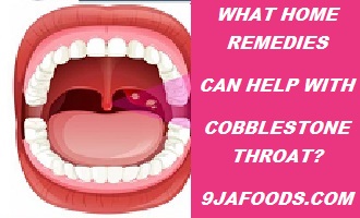 Cobblestone Throat Home Remedies