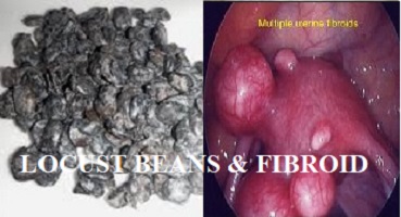 Locust Beans and Fibroid