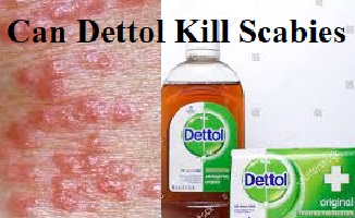 Can Dettol Kill Scabies?