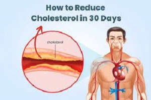 how to reduce cholesterol in 30 days