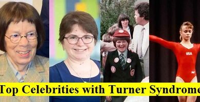 Top Celebrities with Turner syndrome
