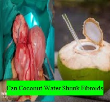 Can Coconut Water Shrink Fibroids?