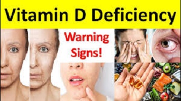 Vitamin D Deficiency Causes