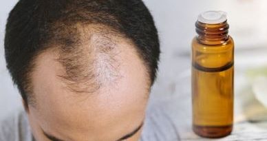 Tea Tree Oil for Hair Growth